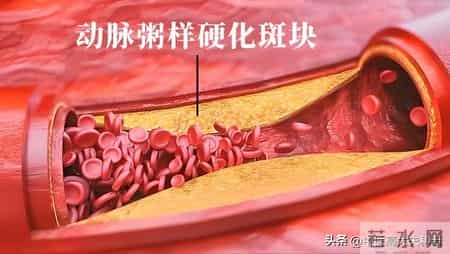 橘子再次被关注！医生发现：冠心病患者常吃橘子，或出现5种变化