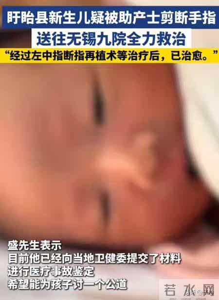 痛死了！新生儿被剪断手指紧急转院， 家属发声暂不谈赔偿太扎心