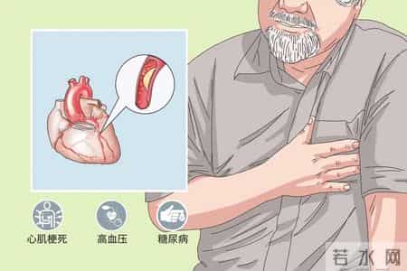 诱发冠心病加重的原因，熬夜仅排第 5，排第 1 的多数人不在意！