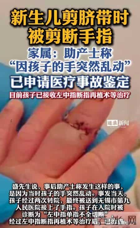 痛死了！新生儿被剪断手指紧急转院， 家属发声暂不谈赔偿太扎心