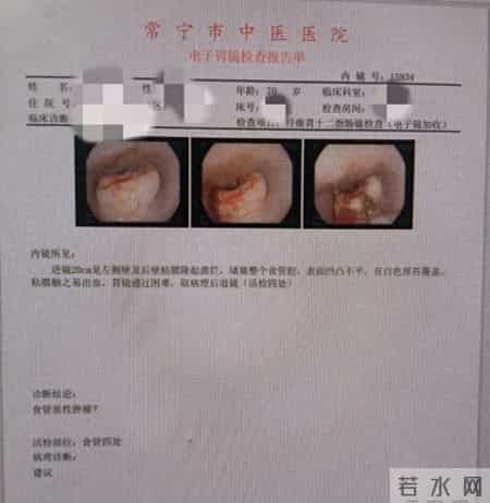 开启肿瘤诊疗技术新篇！常宁市中医医院顺利完成肿瘤患者化学治疗