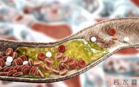 一66岁大妈喜欢睡前泡脚，不久脑梗去世，医生怒斥：太无知了