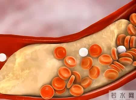 专家研究：每天多吃一个鸡蛋，糖尿病和类风湿或会增加？可信吗？