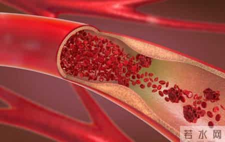 医生告诫：最伤害血管的行为，不是饮食！而是频繁的去做这4件事