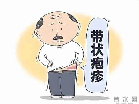 带状疱疹都是咋来的医生调查发现-患带状疱疹的人，有这8大共性