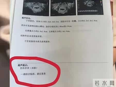 孕妇每次产检，医生都告诉她肚里又多一个孩子，你说奇怪不奇怪？