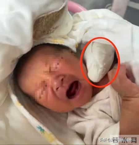 太离谱，手指被当脐带剪断！新生儿脸涨红哭得撕心裂肺，好心疼