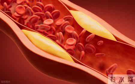 血栓“大户”被揪出，是肥肉的15倍！医生：经常吃，血管或扛不住