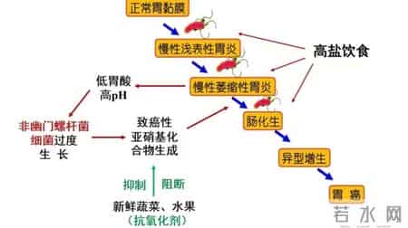 为什么很多人不愿做胃镜？医生：做一次胃镜，或能保你5年没问题