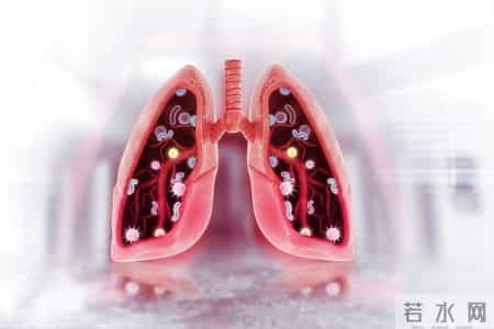 肺癌真凶找到了！医生提醒：不想被肺癌“带走”！3件事忽视不得