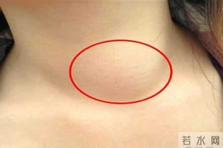 胃癌复发的8个危险信号！忠告：出现一个就检查，别忽视潜在风险