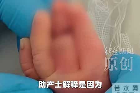 太离谱！新生儿手指被当脐带剪断，脸涨红，哭得撕心裂肺