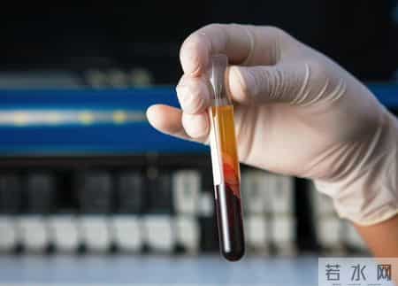 在血常规检查中，知名专家：这2项数值异常，可能是肿瘤信号！