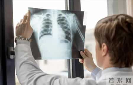 以为骨质疏松，结果是肺癌！这3种腿部表现，可能是肺在“求救”
