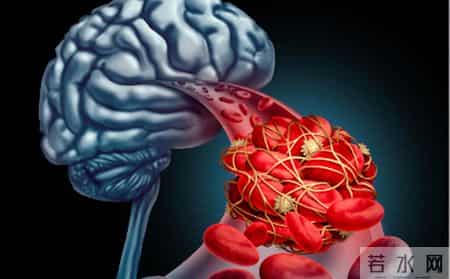 男子因脑梗不幸走了！提醒：天冷宁愿在家打牌，也别干这2事！