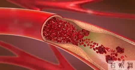 越来越多的人心梗离世！医生再三提醒：少吃芹菜，多吃这几种食物