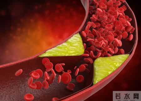 医生告诫：最能加重脑梗的行为，不是熬夜！而是频繁的去做这3事