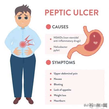 吃阿司匹林导致胃出血后，还该不该继续吃？