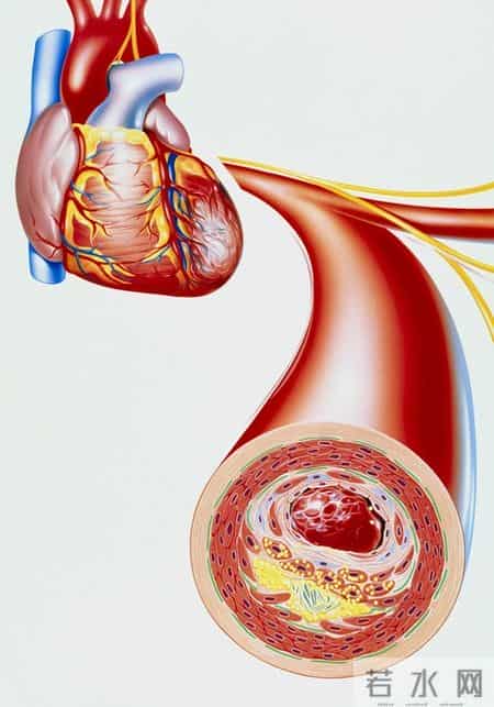 人不会无故患上冠心病？研究发现：患上冠心病，背后有4点原因
