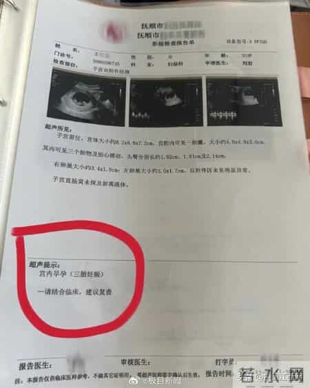 辽宁一孕妇两个月内从一胎变四胞胎，医生：系同卵四胞胎