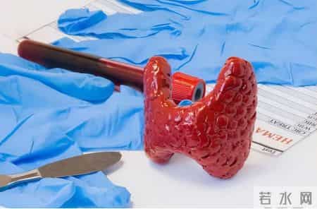 越来越多的人查出甲状腺癌！医生建议：不管男女，4个习惯趁早改