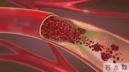 糖尿病患者有三坎，熬过就长寿？三坎是指哪三年？61岁后请重视