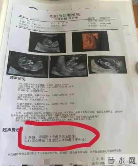 罕见！辽宁一孕妇两个月内产检从一胎“变”四胞胎
