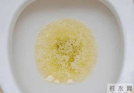 糖尿病患者有三坎，熬过就长寿？三坎是指哪三年？61岁后请重视