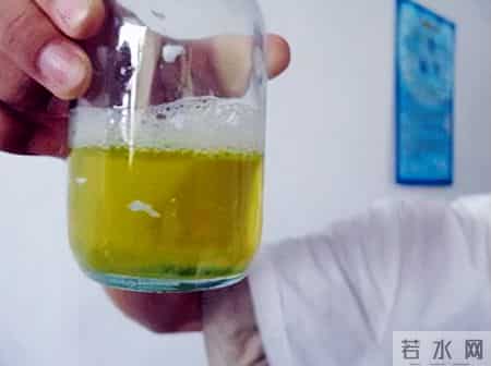 肾脏开始衰竭，排尿先知？医生提醒：排尿出现3异常，尽快去医院