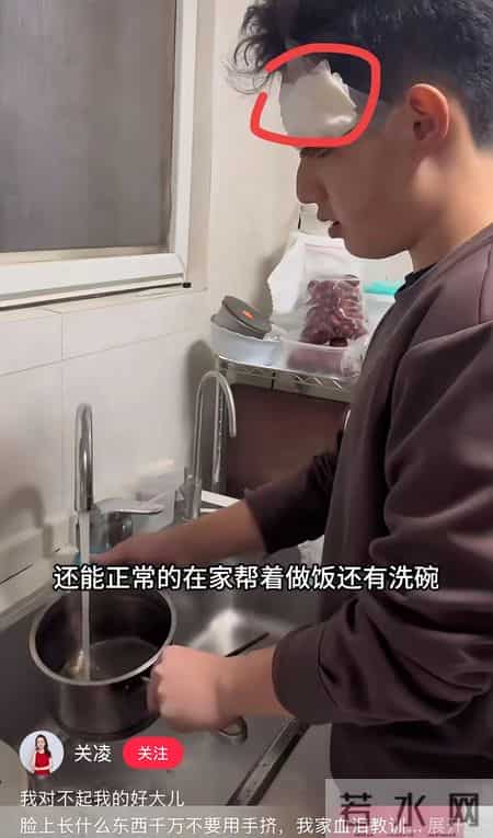 关凌为子挤痘缝4针！真心劝各位家长，别再瞎动手了