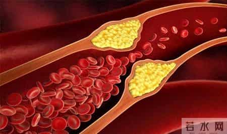 红枣是高血脂的催命符？医生：想要降血脂，这几种食物要少吃