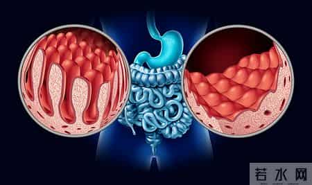 为啥很多人不愿意做肠镜？外国研究：做一次肠镜，或保十年安全？