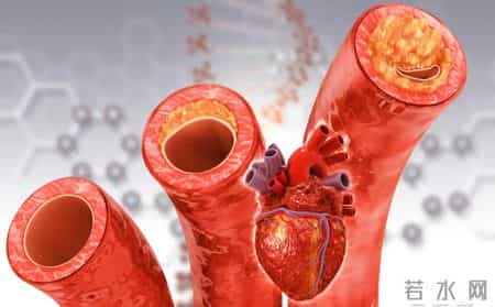 知名大学：高血压患者补叶酸，血管张力降低，中风风险降近三成半