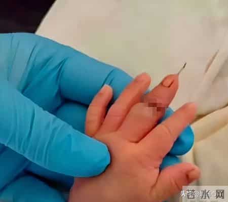 一声啼哭变惨叫！产房操作失误谁来担责？