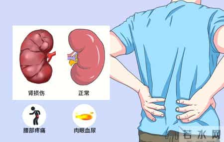 体检发现 3 项指标异常？大概率是慢性肾病早期前兆，别忽视早检查