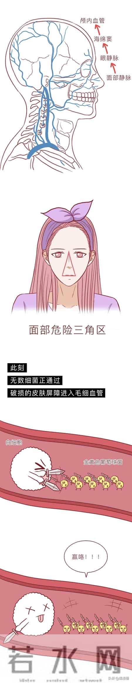 因为这个小动作，我差点被送进ICU，甚至有人被颅内感染