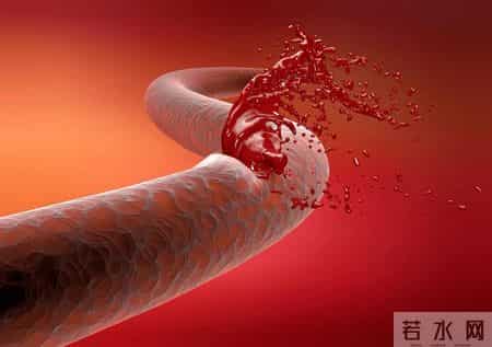 医生研究发现：每日饮酒的糖尿病人，多数临近60岁或有6种异样