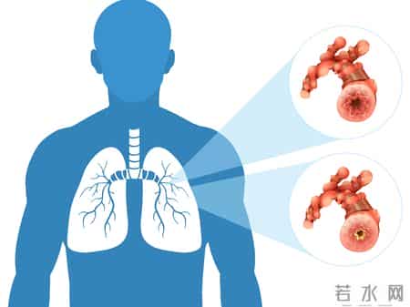 吸烟又火了？医生研究发现：肺炎患者在吸烟时，需要多注意这7点