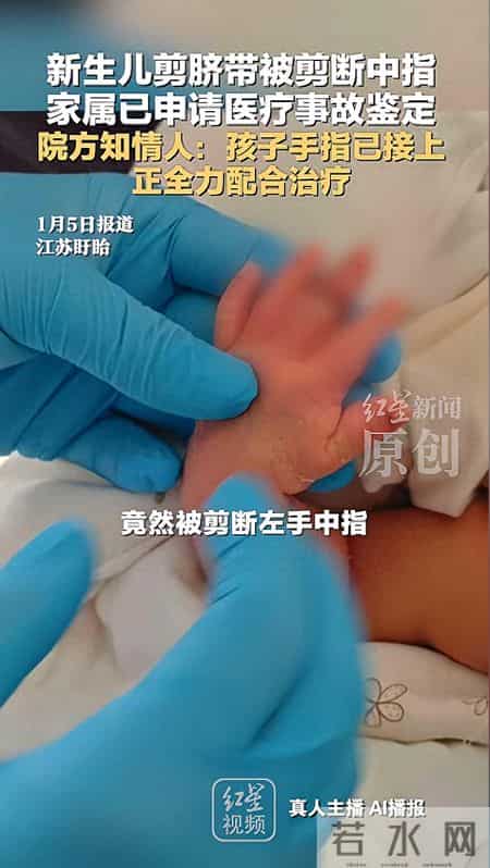 太离谱！新生儿手指被当脐带剪断，脸涨红，哭得撕心裂肺