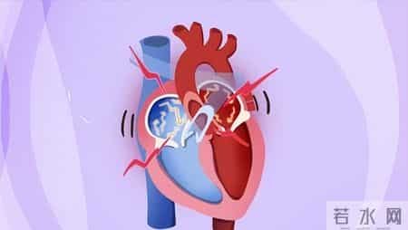 房颤引发卒中 3 预警信号！忠告：出现一个就就医，别错过救治时机