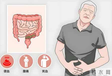 超万人研究：长期低剂量他汀，或与癌症风险降低存在关联性
