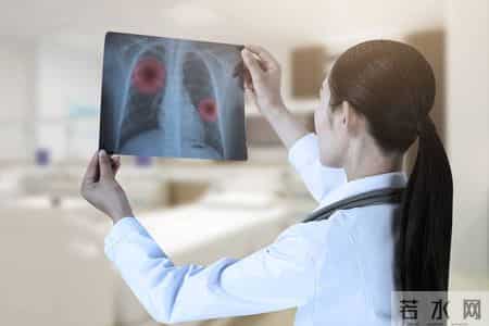 多名医生忠告：慢阻肺患者做过肺功能检测，务必重点4项核心结果