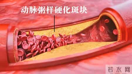 调查发现：爱吃辣椒的人，胃癌、糖尿病、全因死亡率，比同龄人低