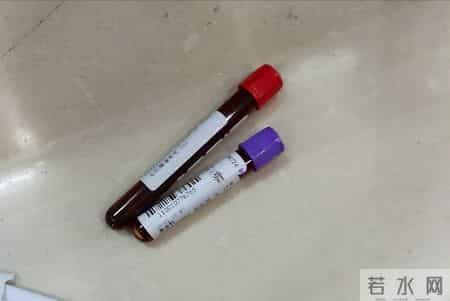 为什么很多人不愿做肠镜？医生：做一次肠镜，或能保你7年没问题