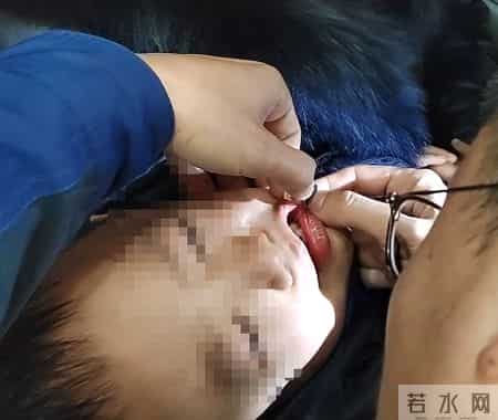 【提示】家长快看！娃鞋上的这个小零件，可能藏着大危险