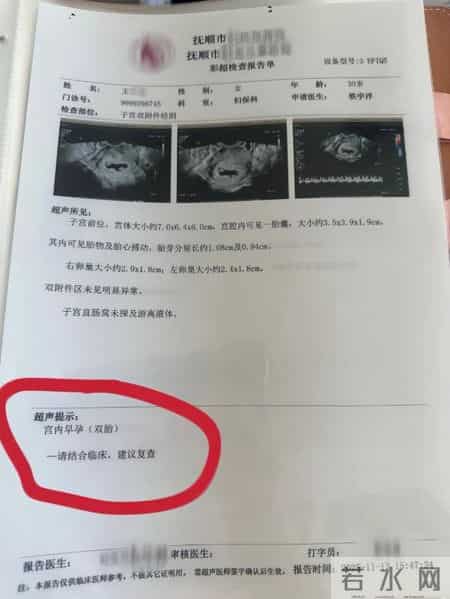 概率仅1300万分之一！辽宁孕妇产检一胎变同卵四胎：尚无异常，只是4个月胖20斤