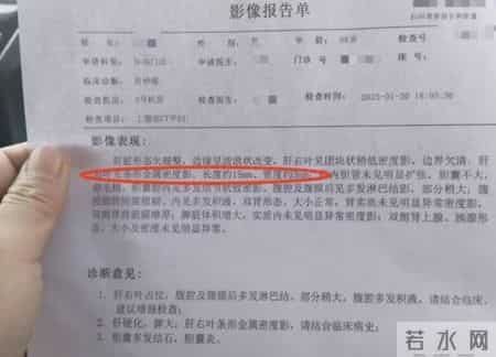 多名医生提醒：只要做过CT检查，中老年人务必重视这4指标！