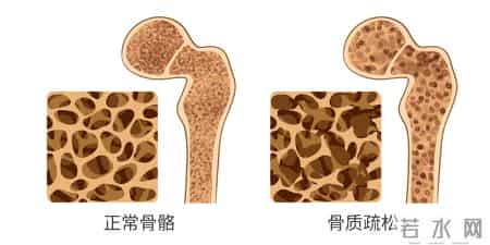 多名医生提醒：只要做过CT检查，中老年人务必重视这4指标！