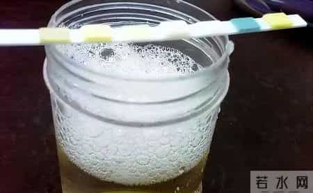 糖尿病恶化的5个身体信号！医生警告：出现1个就该重视，别再拖了