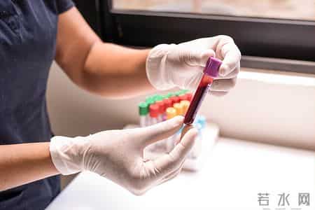 院士多次提醒：年龄过了55岁，体检主要查这6大项，别再盲目乱查